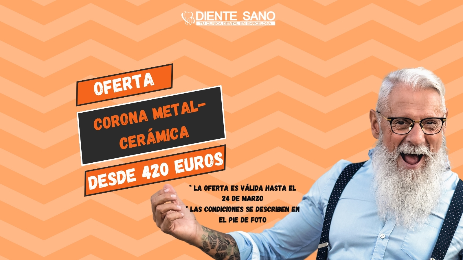 Restaura la belleza y funcionalidad de tu sonrisa con la oferta ventajosa de la clínica dental Diente Sano en Barcelona. Estamos encantados de ofrecerte una corona metal-cerámica a un precio especial desde 420 euros. Esta es la solución ideal para restaurar dientes, combinando la resistencia del metal con la apariencia natural de la cerámica.