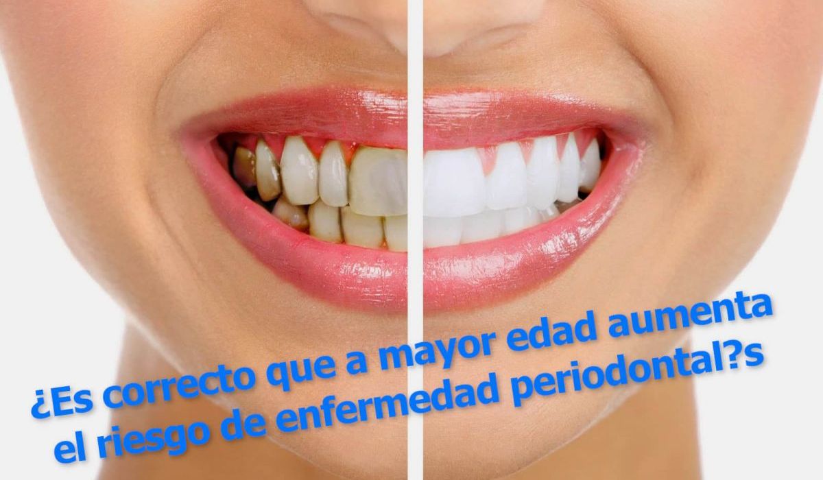 ¿Es correcto que a mayor edad aumenta el riesgo de enfermedad periodontal?