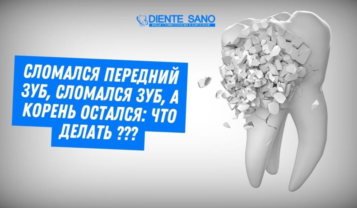 Сломался передний зуб, сломался зуб, а корень остался: что делать ?