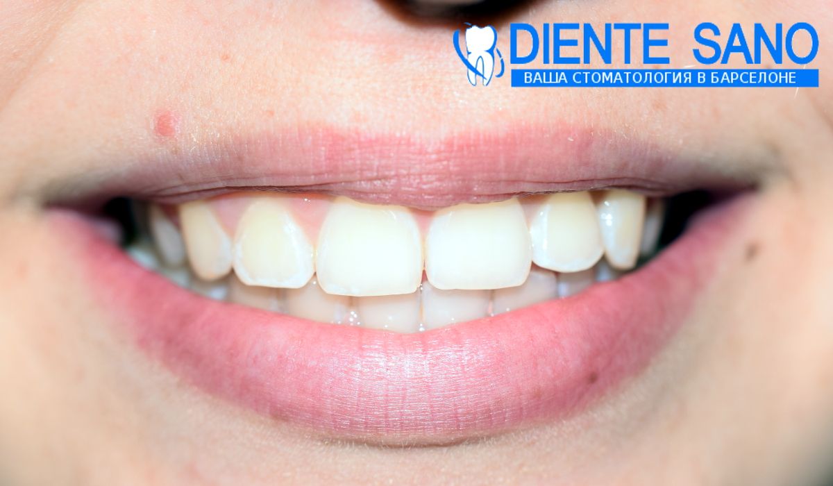 Orthodontics in Barcelona