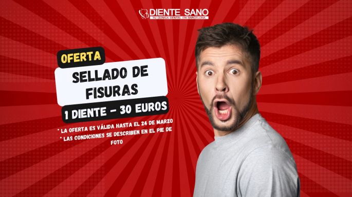 ¡Oferta especial en la clínica dental Diente Sano en Barcelona!: El cuidado de tu sonrisa comienza con la prevención. Te ofrecemos una oferta única para la selladura de fisuras de un diente por solo 30 euros.