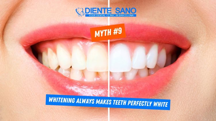 Teeth Whitening in Barcelona: Myths and Facts