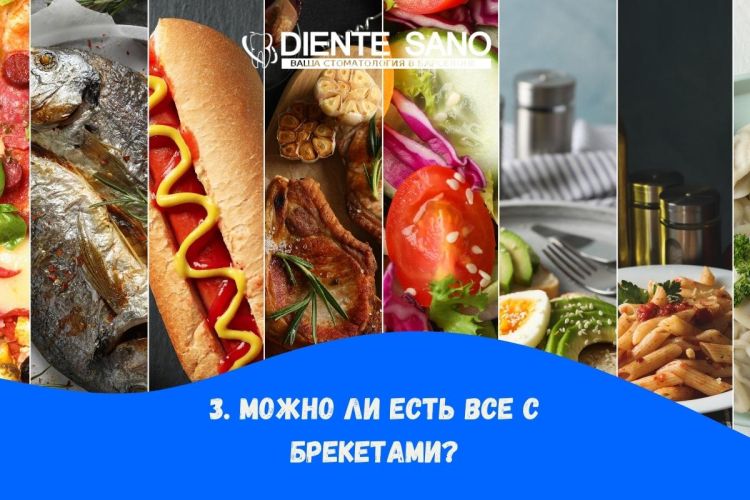 Часто задаваемые вопросы о брекетах: все, что вам нужно знать. Можно ли есть все с брекетами?