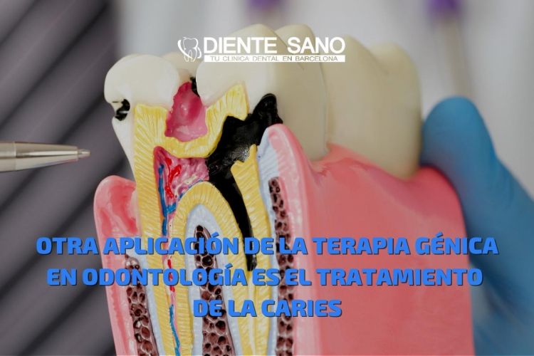 La terapia génica. El uso de la terapia génica en odontología