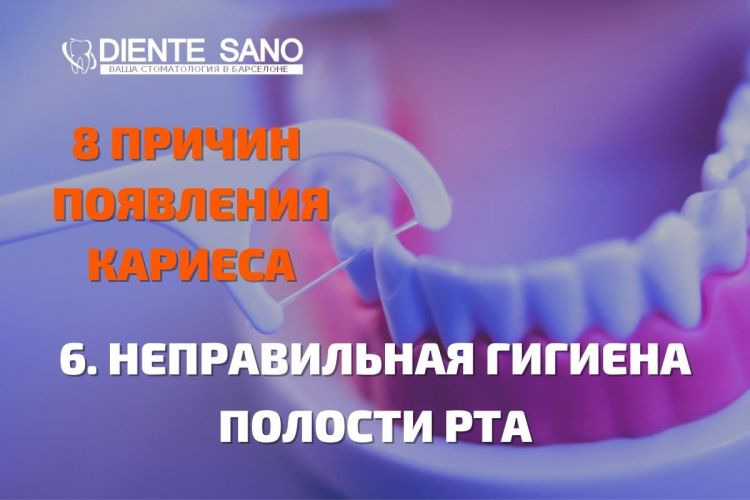 8 причин появления кариеса, советы стоматолога! Не надо забывать про правильную гигиену полости рта. 